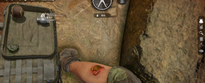 绿色地狱摔伤怎么治疗3